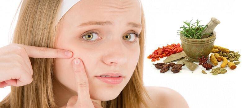 herbal treatment for acne